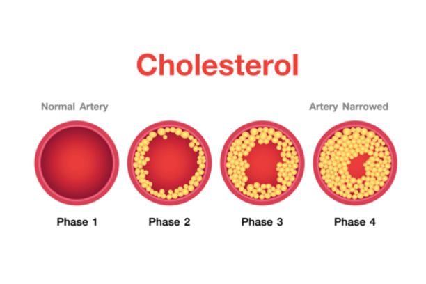 Cholesterol phases