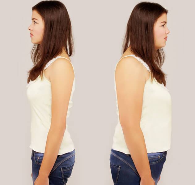 Hormones leads weight gain