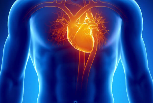 High-Cholesterol-and-Heart-Diseases High-Cholesterol-and-Heart-Diseases