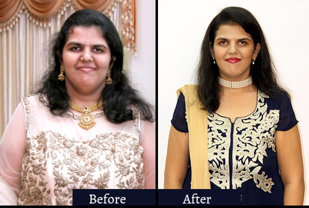 Niharika before & after weight loss