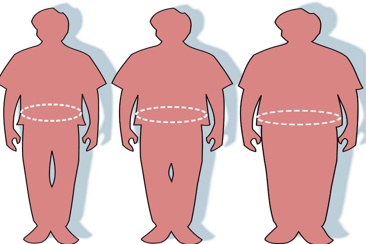 The Stages Of Weight Gain And The Treatment For Obesity - Truweight